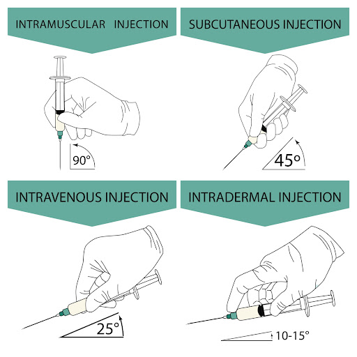 Injection angle diagram - IM 90°, SubQ 45°, IV 25°, intradermal 10–15°
